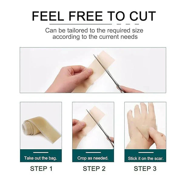 Silicone Gel Sheets – Gentle Scar Reduction Therapy